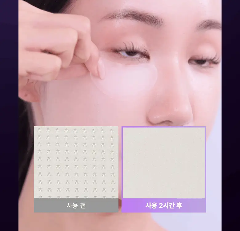 [NEW|아이백리프팅] 바이오힐보 프로바이오덤 콜라겐 PDRN 아이백 & 미간 패치 6,800샷 상세페이지 25
